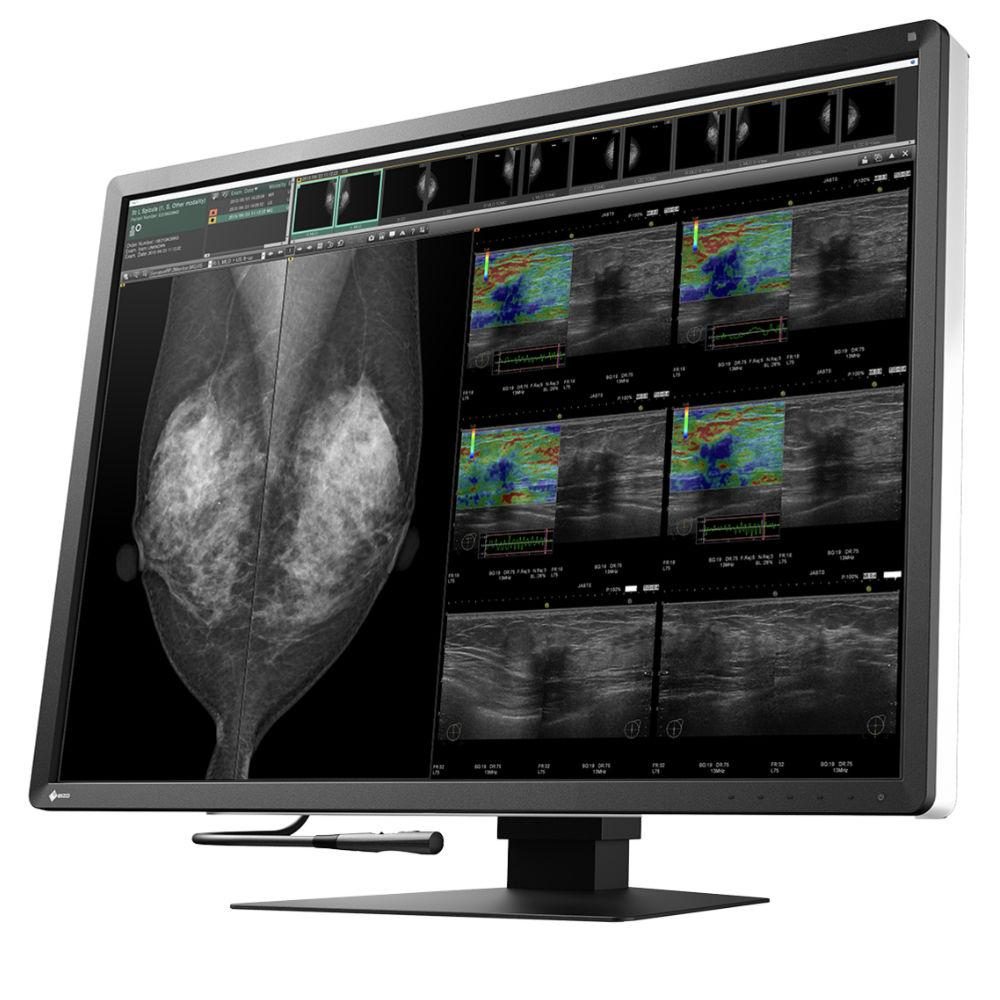 Медицински монитор EIZO RadiForce RX1270 12MP Цветен – Снимка 2