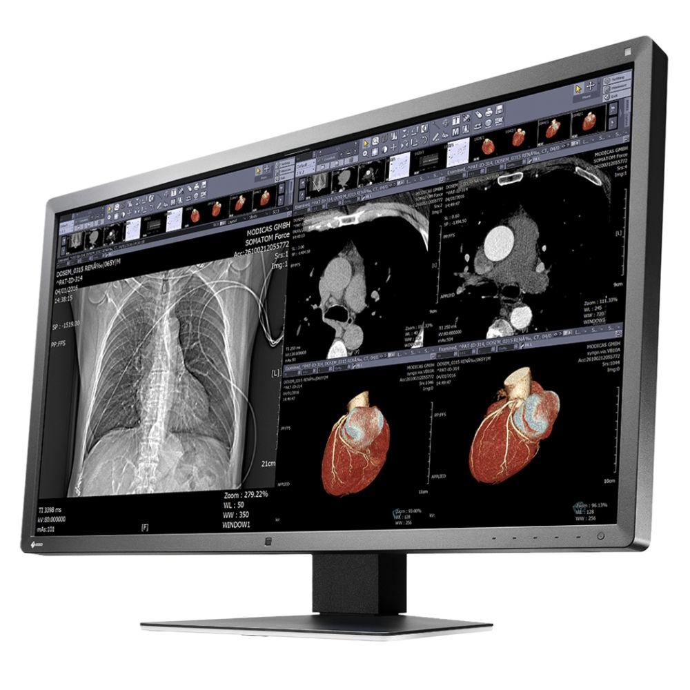 Медицински монитор EIZO RadiForce MX315W 8MP Цветен – Снимка 2