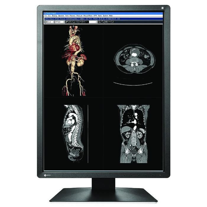 Медицински монитор EIZO RadiForce MX216-SB 2MP Цветен – Снимка 2