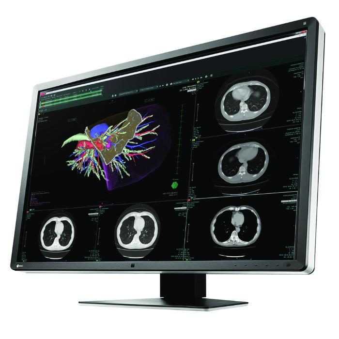 Медицински монитор EIZO RadiForce RX660 6MP Цветен – Снимка 2
